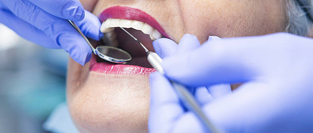 Best Dentist for Tooth Abscess  in Rothschild, WI